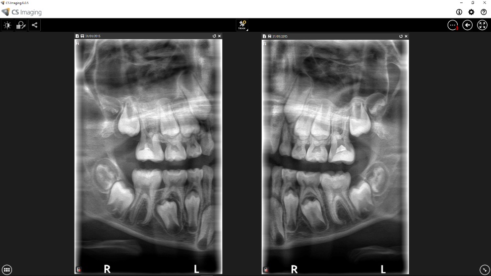 Software CS Imaging Carestream - integración digital